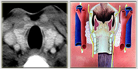 Anatomie topographique de la thyroide
