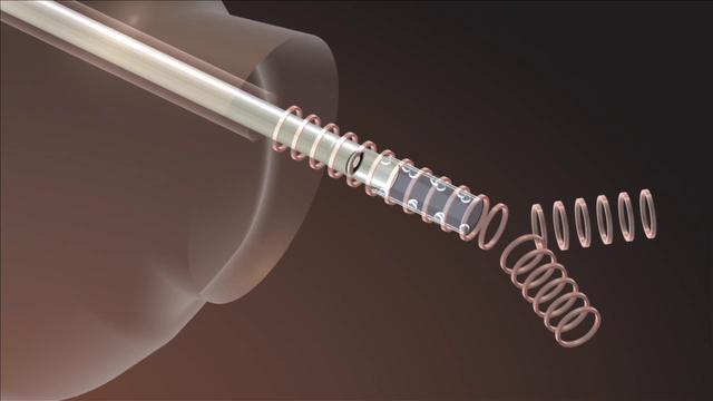 EFER - Bronchoscope Serie 3
